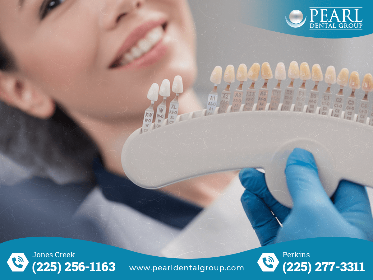 Professional Teeth Cleaning in Baton Rouge
